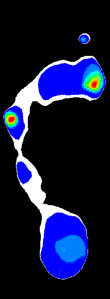 Plantar Pressure Adjust to A